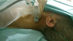 Ułożenie głowicy przy lokalizacji splotu ramiennego w szcelinie mięśni pochyłych